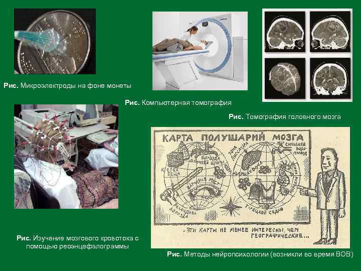 Рис. Микроэлектроды на фоне монеты Рис. Компьютерная томография Рис. Томография головного мозга Рис. Изучение
