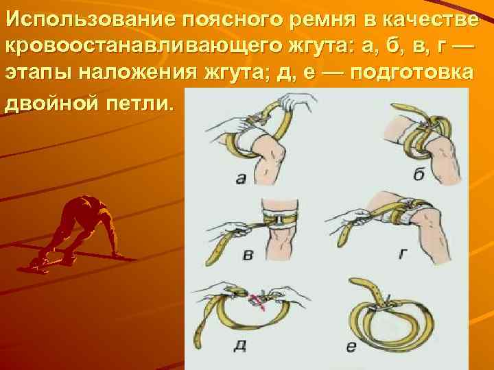 Правильный жгут. Качество наложения кровоостанавливающего жгута. Применение кровоостанавливающего жгута. Наложение ремня в качестве жгута.