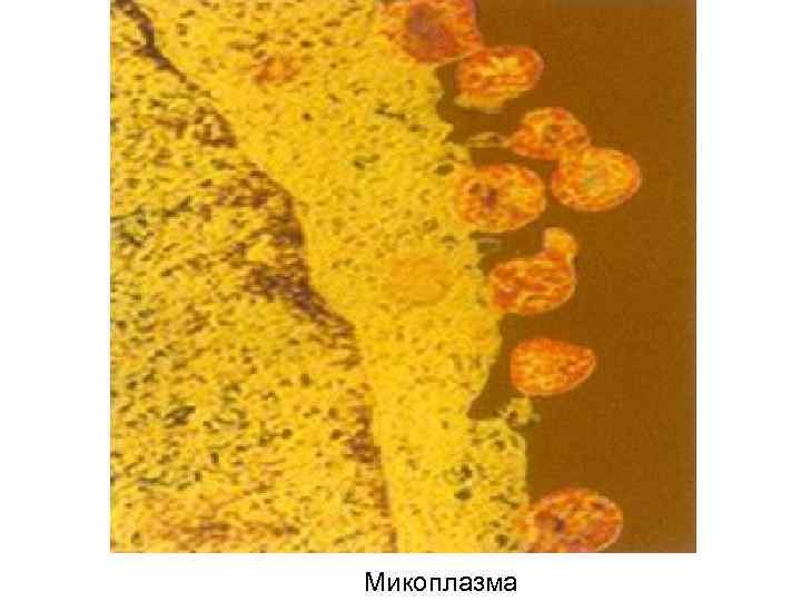 Микоплазма 