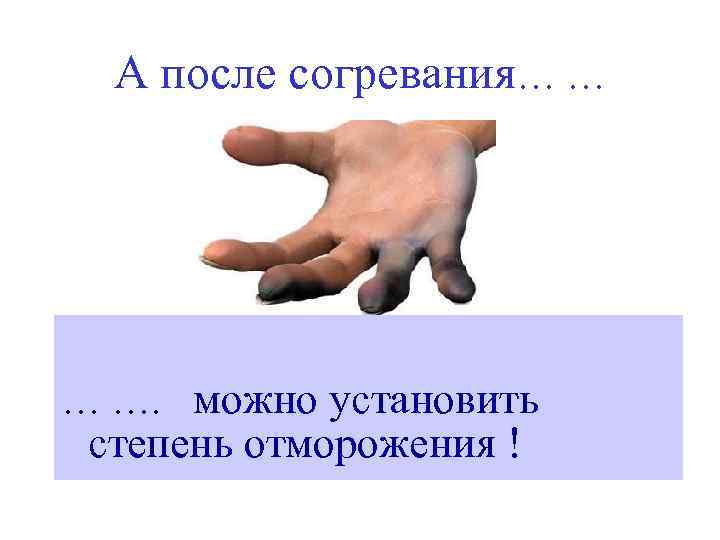 А после согревания… … … …. можно установить степень отморожения ! 