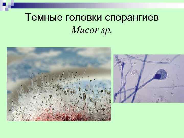 Темные головки спорангиев Mucor sp. 