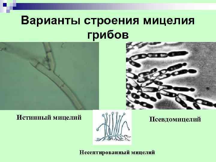  Варианты строения мицелия грибов Истинный мицелий Псевдомицелий Несептированный мицелий 