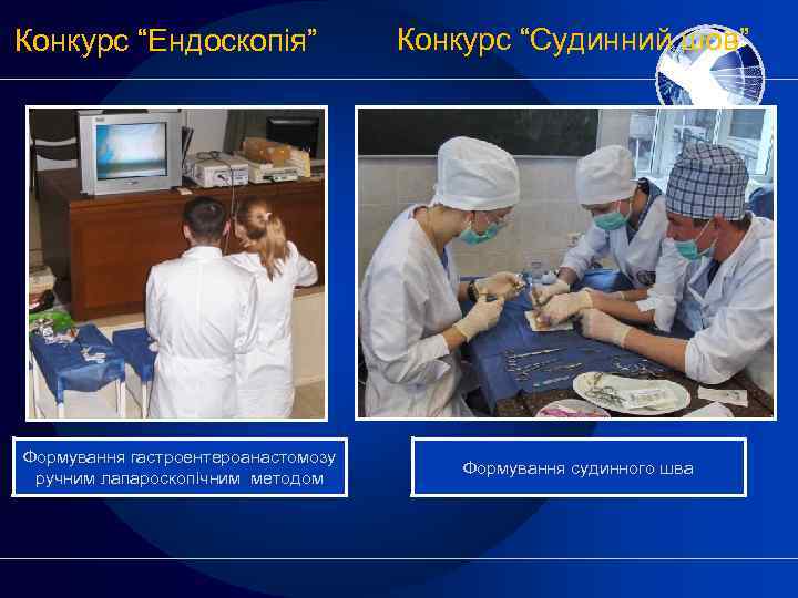 Конкурс “Ендоскопія” Формування гастроентероанастомозу ручним лапароскопічним методом Конкурс “Судинний шов” Формування судинного шва 
