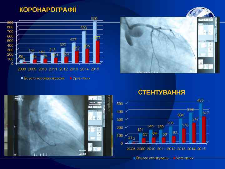 КОРОНАРОГРАФІЇ СТЕНТУВАННЯ 