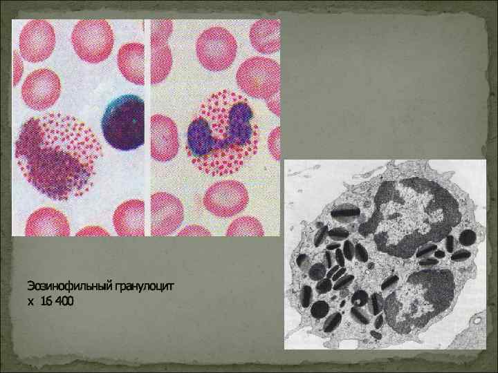 Эозинофильный гранулоцит х 16 400 