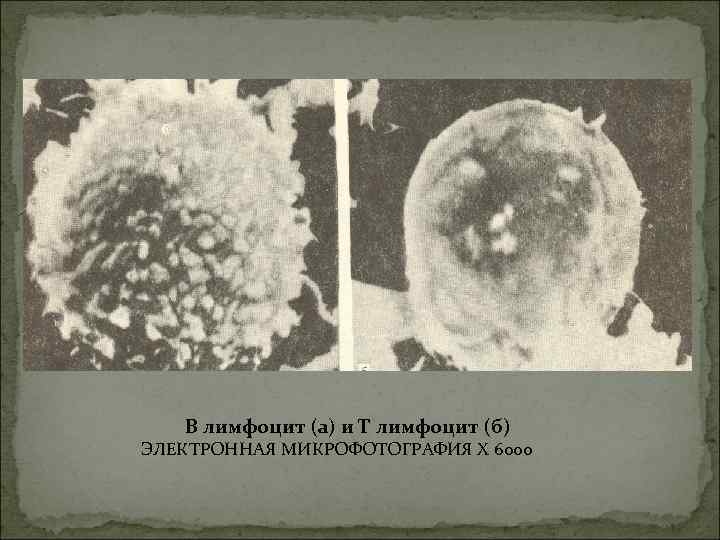 В лимфоцит (а) и Т лимфоцит (б) ЭЛЕКТРОННАЯ МИКРОФОТОГРАФИЯ X 6000 