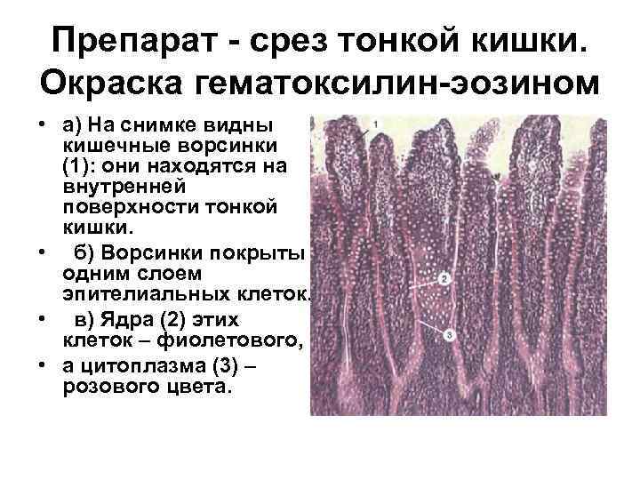 Препарат - срез тонкой кишки. Окраска гематоксилин-эозином • а) На снимке видны кишечные ворсинки