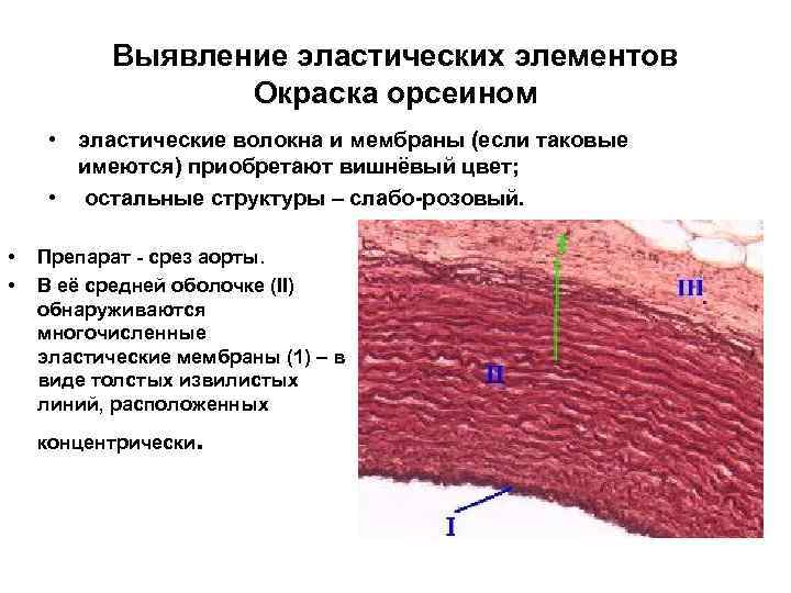 Выявление эластических элементов Окраска орсеином • эластические волокна и мембраны (если таковые имеются) приобретают