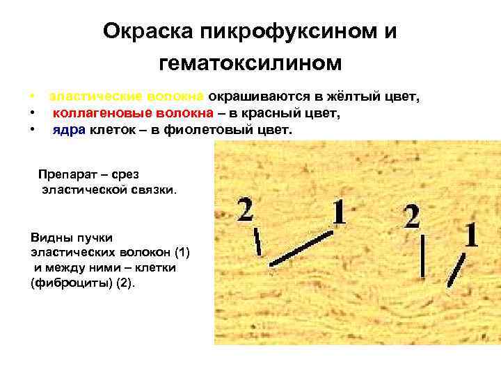 Окраска пикрофуксином и гематоксилином • эластические волокна окрашиваются в жёлтый цвет, • коллагеновые волокна