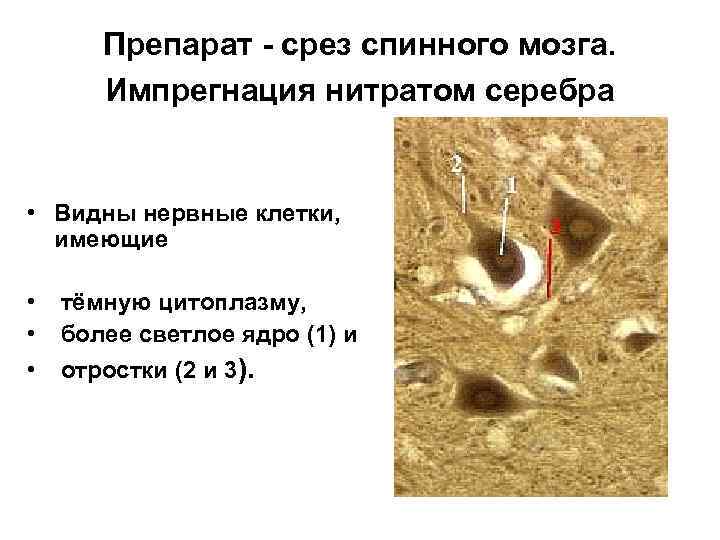 Препарат - срез спинного мозга. Импрегнация нитратом серебра • Видны нервные клетки, имеющие •