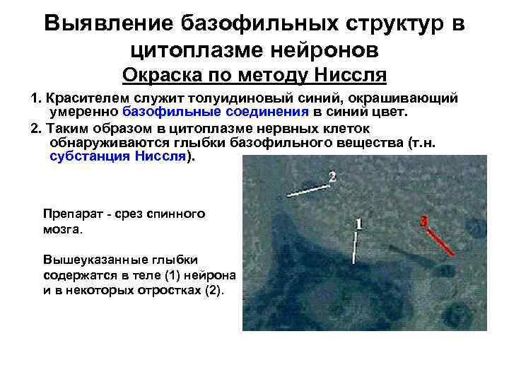 Выявление базофильных структур в цитоплазме нейронов Окраска по методу Ниссля 1. Красителем служит толуидиновый