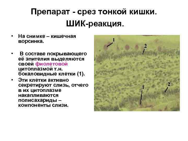 Препарат - срез тонкой кишки. ШИК-реакция. • На снимке – кишечная ворсинка. • В
