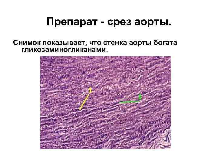 Препарат - срез аорты. Снимок показывает, что стенка аорты богата гликозаминогликанами. 