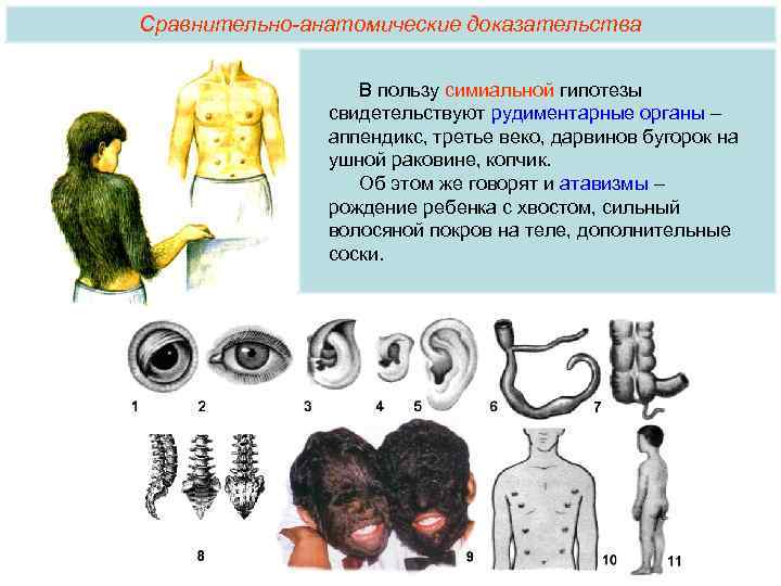 Сравнительно-анатомические доказательства В пользу симиальной гипотезы свидетельствуют рудиментарные органы – аппендикс, третье веко, дарвинов