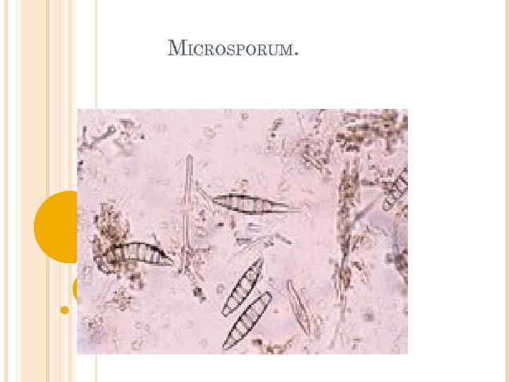 MICROSPORUM. 