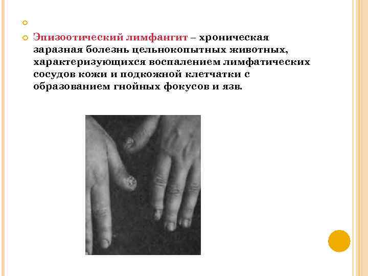  Эпизоотический лимфангит – хроническая заразная болезнь цельнокопытных животных, характеризующихся воспалением лимфатических сосудов кожи