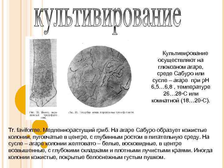 Культивирование осуществляют на глюкозном агаре, среде Сабуро или сусле – агаре при р. Н