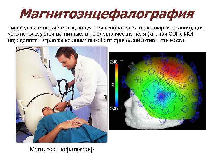  Магнитоэнцефалография - исследовательский метод получения изображения мозга (картирования), для чего используются магнитные, а