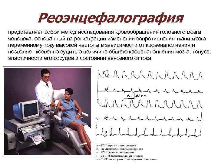  Реоэнцефалография представляет собой метод исследования кровообращения головного мозга человека, основанный на регистрации изменений