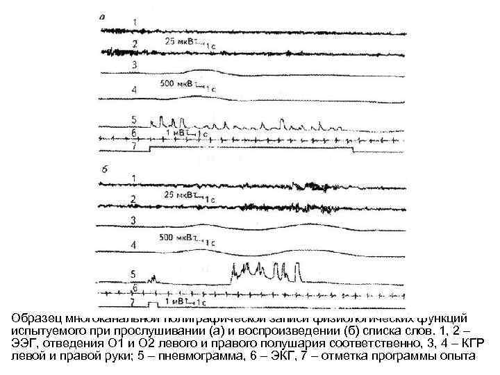 Образец многоканальной полиграфической записи физиологических функций испытуемого при прослушивании (а) и воспроизведении (б) списка