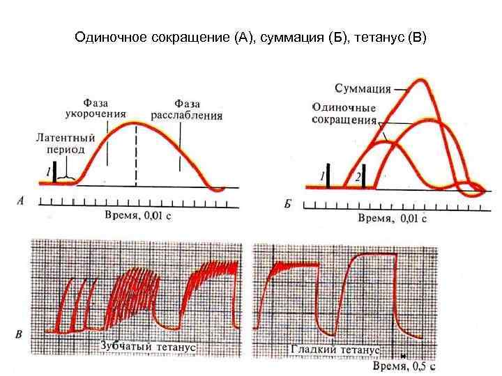 Одиночное сокращение (А), суммация (Б), тетанус (В) 