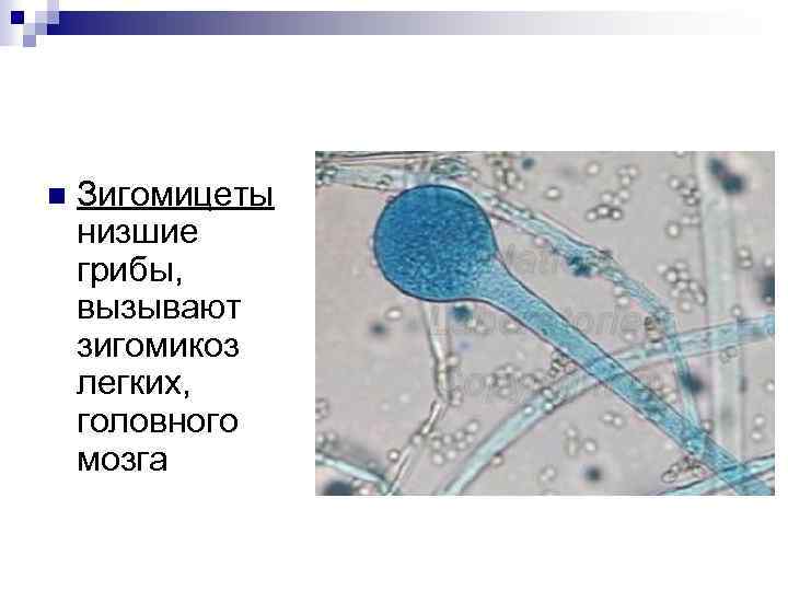  Зигомицеты низшие грибы, вызывают зигомикоз легких, головного мозга 