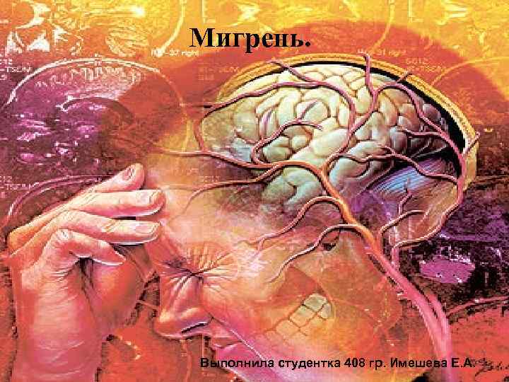 Мигрень. Выполнила студентка 408 гр. Имешева Е. А. 