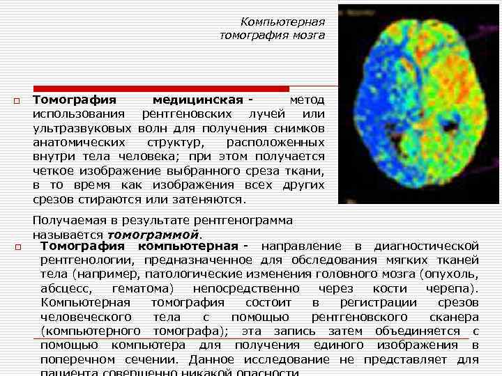 Для получения изображения в компьютерной томографии используется