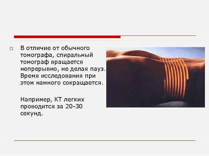 o В отличие от обычного томографа, спиральный томограф вращается непрерывно, не делая пауз. Время o В отличие от обычного томографа, спиральный томограф вращается непрерывно, не делая пауз. Время