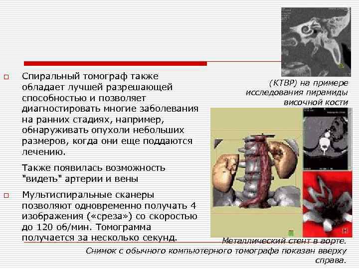 o Спиральный томограф также (КТВР) на примере обладает лучшей разрешающей исследования пирамиды способностью и o Спиральный томограф также (КТВР) на примере обладает лучшей разрешающей исследования пирамиды способностью и
