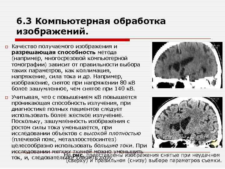 6. 3 Компьютерная обработка изображений. o Качество получаемого изображения и разрешающая способность метода 6. 3 Компьютерная обработка изображений. o Качество получаемого изображения и разрешающая способность метода