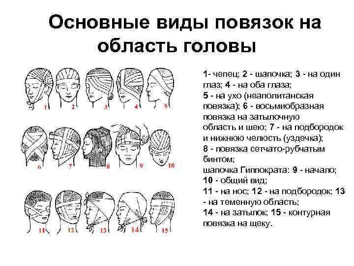  Основные виды повязок на область головы 1 - чепец; 2 - шапочка; 3