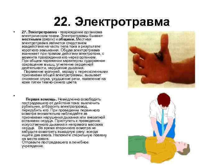 22. Электротравма • 27. Электротравма - повреждение организма электрическим током. Электротравмы бывают местными (ожоги)