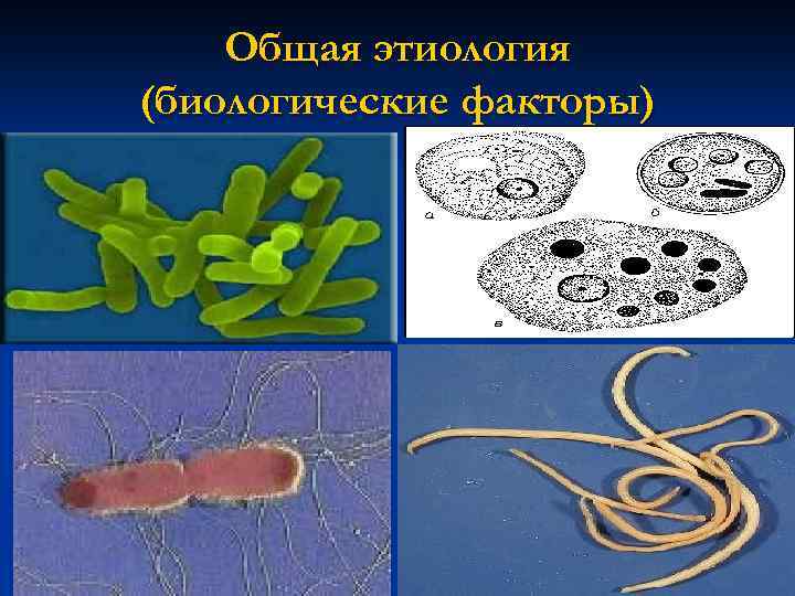 Общая этиология (биологические факторы) 