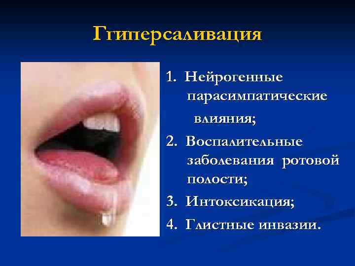 Ггиперсаливация 1. Нейрогенные парасимпатические влияния; 2. Воспалительные заболевания ротовой полости; 3. Интоксикация; 4. Глистные