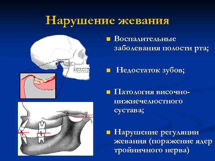 Нарушение жевания n Воспалительные заболевания полости рта; n Недостаток зубов; n Патология височнонижнечелюстного сустава;