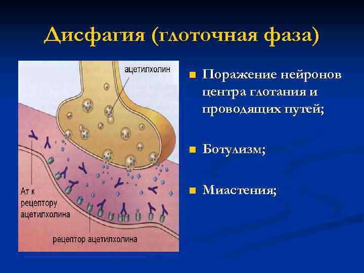 Дисфагия (глоточная фаза) n Поражение нейронов центра глотания и проводящих путей; n Ботулизм; n