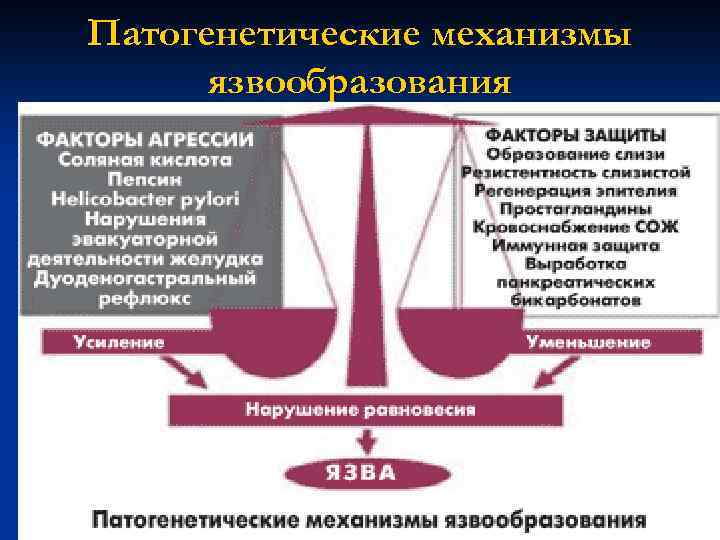 Патогенетические механизмы язвообразования 