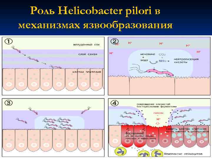 Роль Helicobacter pilori в механизмах язвообразования 