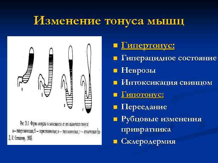 Изменение тонуса мышц n Гипертонус: n Гиперацидное состояние Неврозы Интоксикация свинцом Гипотонус: Переедание Рубцовые