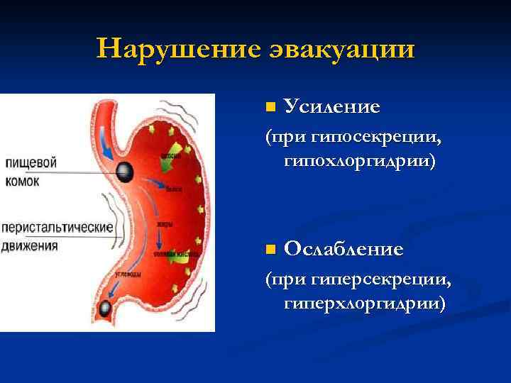 Нарушение эвакуации n Усиление (при гипосекреции, гипохлоргидрии) n Ослабление (при гиперсекреции, гиперхлоргидрии) 