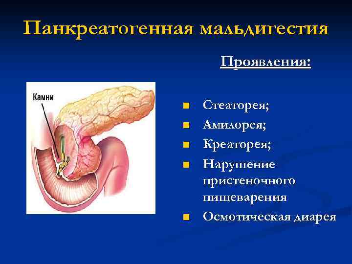 Панкреатогенная мальдигестия Проявления: n n n Стеаторея; Амилорея; Креаторея; Нарушение пристеночного пищеварения Осмотическая диарея