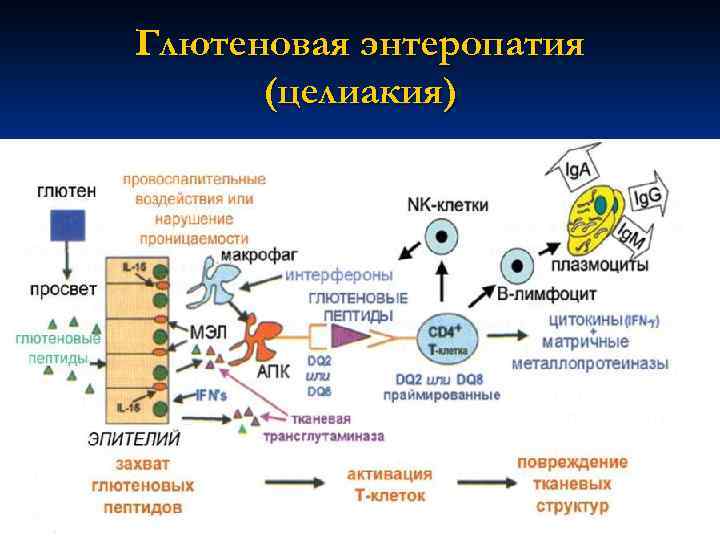 Глютеновая энтеропатия (целиакия) 