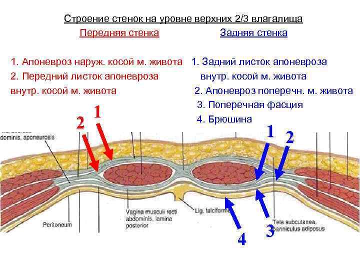 Передняя стенка влагалища фото