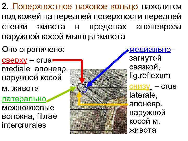 Поверхностное кольцо. Поверхностное паховое кольцо. Поверхностное паховое кольцо ограничено. Наружное отверстие пахового кольца. Стенки поверхностного пахового кольца.