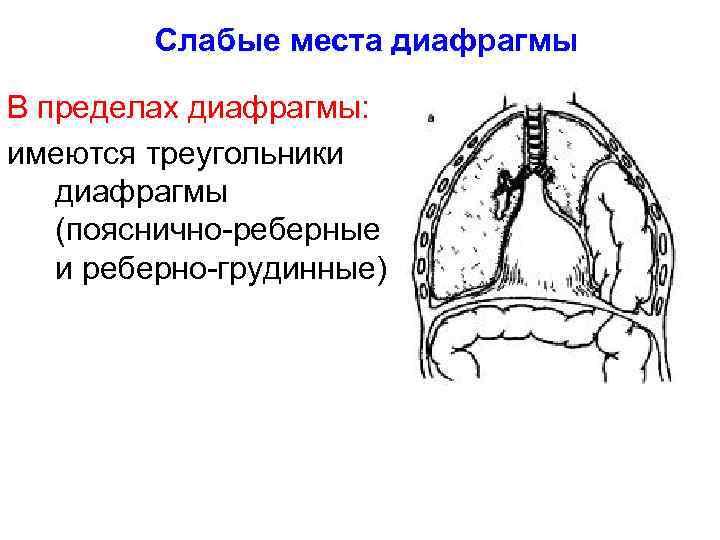 Слабые места диафрагмы В пределах диафрагмы: имеются треугольники диафрагмы (пояснично-реберные и реберно-грудинные) 