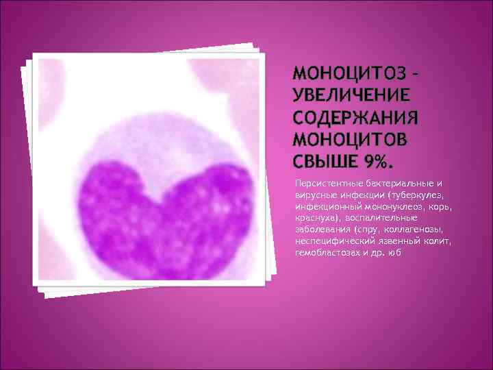 МОНОЦИТОЗ – УВЕЛИЧЕНИЕ СОДЕРЖАНИЯ МОНОЦИТОВ СВЫШЕ 9%. Персистентные бактериальные и вирусные инфекции (туберкулез, инфекционный