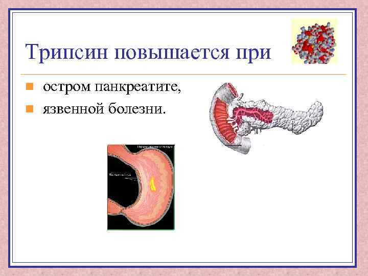 Трипсин повышается при n n остром панкреатите, язвенной болезни. 