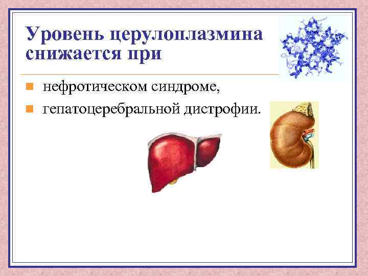 Уровень церулоплазмина снижается при n n нефротическом синдроме, гепатоцеребральной дистрофии. 
