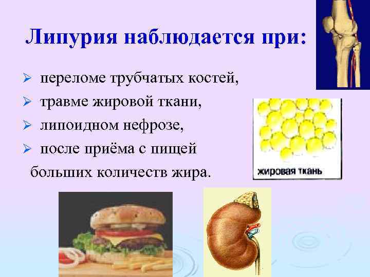 Липурия наблюдается при: переломе трубчатых костей, Ø травме жировой ткани, Ø липоидном нефрозе, Ø